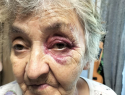Подростки на электросамокате сбили в Волгодонске 76-летнюю пенсионерку и наблюдали за ее мучениями 