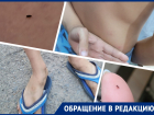 «Мы все в шоке! Это невыносимо! Помогите!»: в Волгодонске жильцов МКД атакуют блохи 