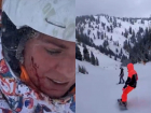 Врезалась в дерево на сноуборде: Юлия Ефимова разбила голову на отдыхе в Айдахо 