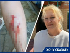 «Кровь не могли остановить два часа»: чипированная собака чуть не отгрызла ногу матери троих детей в Волгодонске  