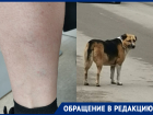 «Повезло не прокусила, а если ребенок?»: собака два раза укусила женщину за ногу на 30 лет Победы
