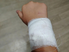 Бездомная собака напала на 8-летнюю девочку на улице Горького