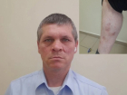 «Из 108 человек в живых осталось только двое»: в Ростовской области после обращения в «Блокнот» участник СВО получил шанс вернуть выплаты на лечение 