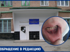 Мужчине вставили на место вырванный по ошибке здоровый зуб в стоматологии Волгодонска