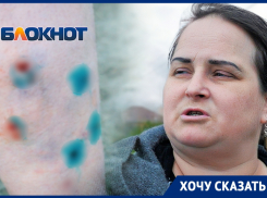 Ужас и дикая боль: дважды за неделю на волгодончанку напали бездомные псы