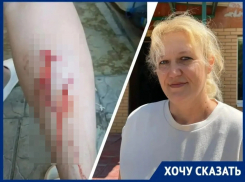 «Кровь не могли остановить два часа»: чипированная собака чуть не отгрызла ногу матери троих детей в Волгодонске  