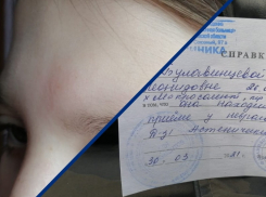 У 12-летней девочки после конфликта в школе и травмы головы диагностировали астенический синдром