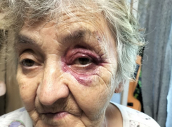 Подростки на электросамокате сбили в Волгодонске 76-летнюю пенсионерку и наблюдали за ее мучениями 