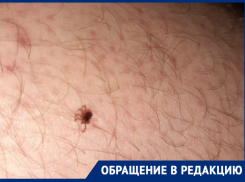 «В борьбе с коронавирусом все забыли о борьбе с клещами»: волгодончанка