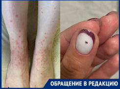 «Блохи даже в кровати»: насекомые из подвала МКД искусали волгодонцев
