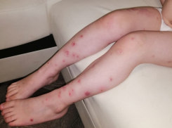 Больше месяца блохи кусали воспитанников детского сада в Волгодонске