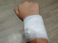 Бездомная собака напала на 8-летнюю девочку на улице Горького
