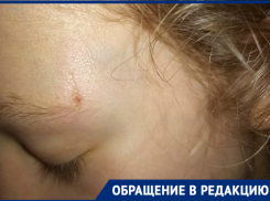 13-летняя волгодончанка ушибла голову в маршрутке при резком торможении 
