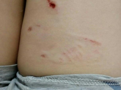 Бездомные собаки искусали до крови 7-летнего ребенка в Волгодонске, - читатель
