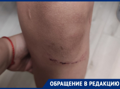 Ребенок провалился в открытый люк в станице Романовской