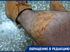 Бездомная собака средь бела дня напала на волгодонца