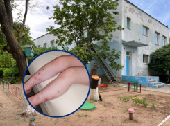 Скандал с блохами в детском саду «Золушка» в Волгодонске получил продолжение
