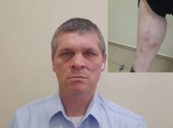 «Из 108 человек в живых осталось только двое»: в Ростовской области после обращения в «Блокнот» участник СВО получил шанс вернуть выплаты на лечение 