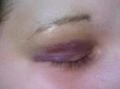 В Волгодонске избили девушку, которая хотела спеть песню в караоке 