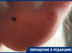 «Это что нашествие?»: волгодончанка за один день сняла несколько клещей со своих двоих детей