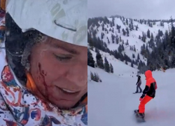 Врезалась в дерево на сноуборде: Юлия Ефимова разбила голову на отдыхе в Айдахо 