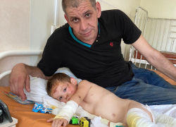 «Больно смотреть, как с твоего ребенка слазит кожа»: отец-одиночка лишился всего после пожара в Волгодонске