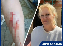 «Кровь не могли остановить два часа»: чипированная собака чуть не отгрызла ногу матери троих детей в Волгодонске  