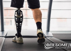 Жизнь после ампутации: «ФлебоМед» дарит надежду и бесплатную помощь людям, утратившим конечности