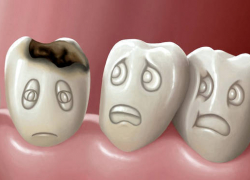 В Волгодонске стоматолог по ошибке вырвала ребенку два здоровых зуба вместо одного больного