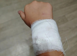Бездомная собака напала на 8-летнюю девочку на улице Горького