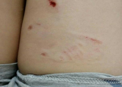 Бездомные собаки искусали до крови 7-летнего ребенка в Волгодонске, - читатель