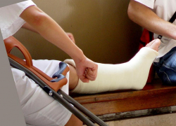 Ссора с мужем закончилась для волгодончанки двумя сломанными ногами