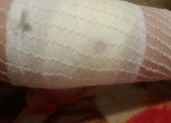 Бродячая собака искусала подростка в районе школы №10 в Волгодонске