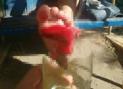 Отдых на базе "Волна" закончился для волгодонца торчащим в ноге стаканом