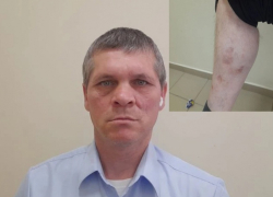 «Из 108 человек в живых осталось только двое»: в Ростовской области после обращения в «Блокнот» участник СВО получил шанс вернуть выплаты на лечение 