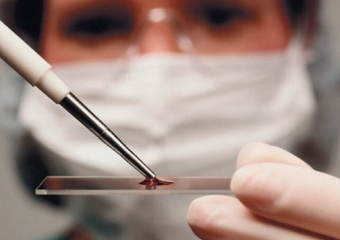 В Волгодонском районе зарегистрирован случай заражения человека туляремией