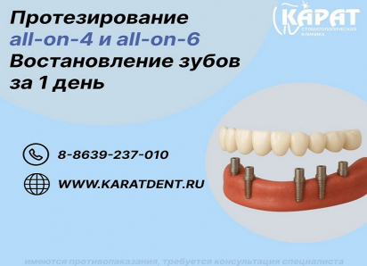 Имплантация All-on-4 и All-on-6