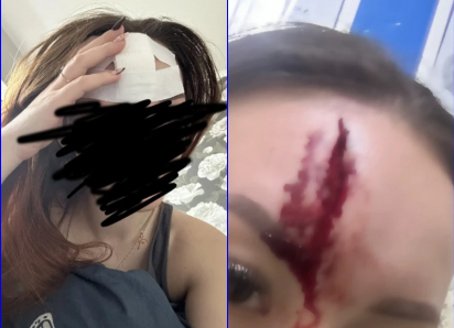 Пострадавшая в ночном ДТП на путепроводе девушка ищет свидетелей «дрифта»  