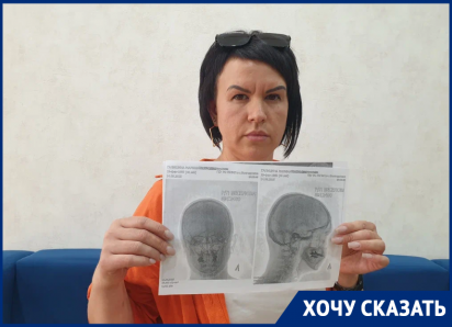 «Я боюсь, что она может облить меня кислотой!»: агрессивная парикмахерша избила женщину в Цимлянске  