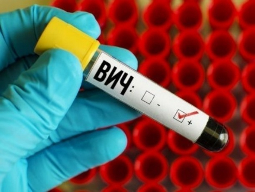 С начала года среди волгодонцев выявлено 8 новых случая ВИЧ-инфекции 