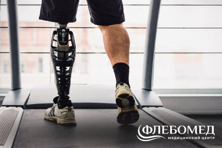 Жизнь после ампутации: «ФлебоМед» дарит надежду и бесплатную помощь людям, утратившим конечности