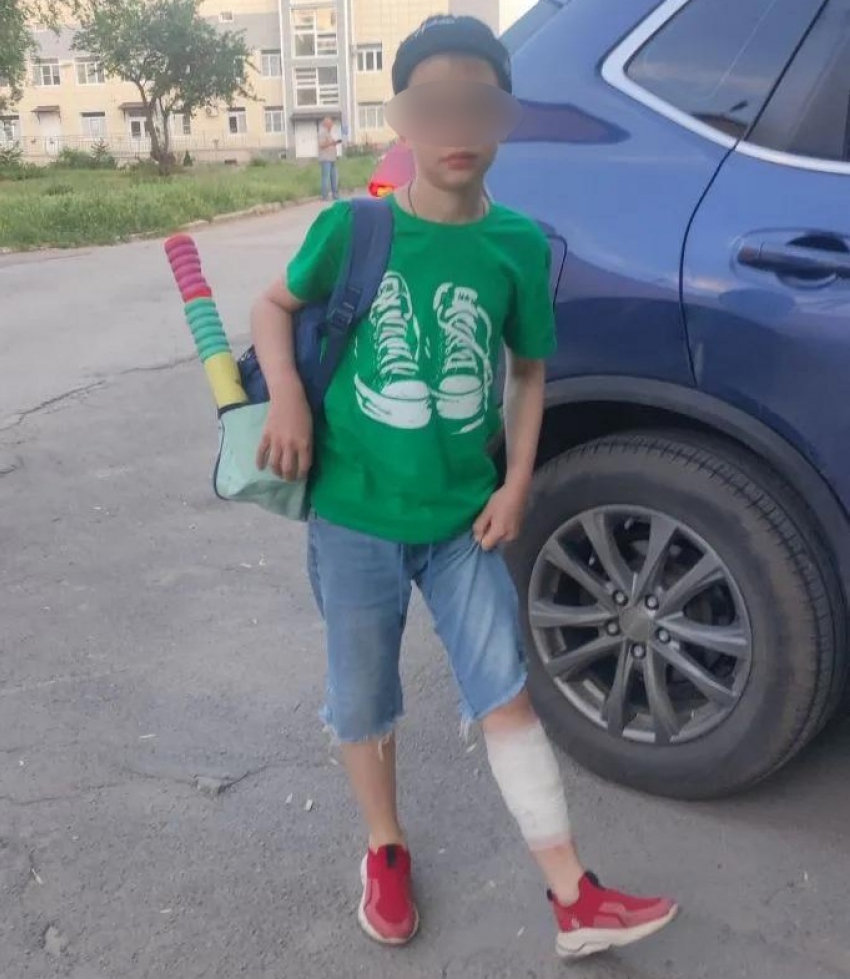 Стая собак напала на 10-летнего мальчика на муниципальном пляже Волгодонска, ребенок ранен