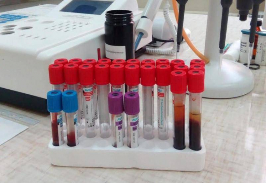 Еще у двух волгодонцев за сутки подтвердили Covid-19 