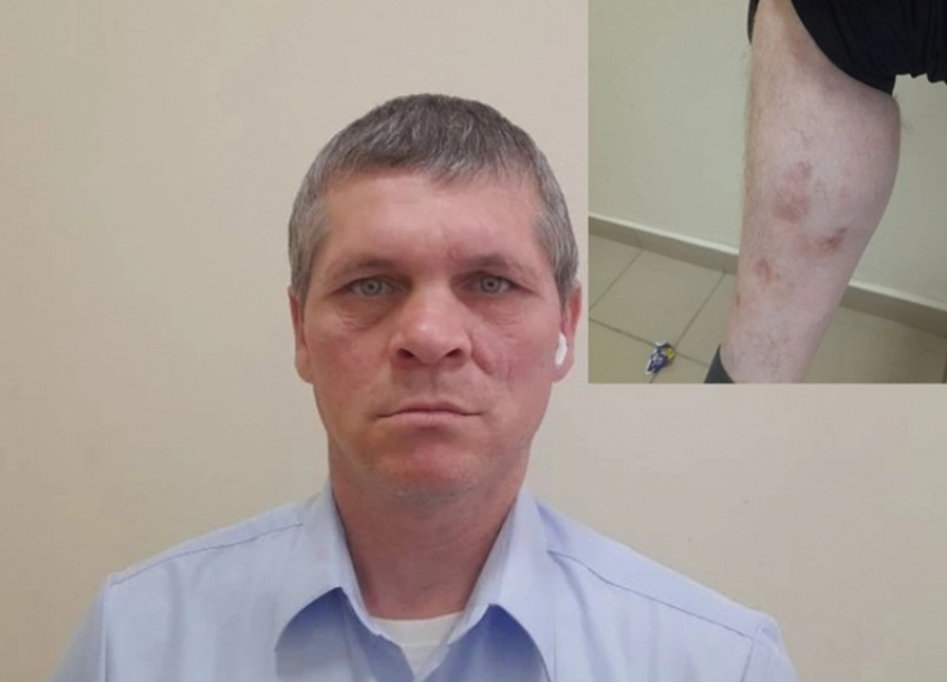 «Из 108 человек в живых осталось только двое»: в Ростовской области после обращения в «Блокнот» участник СВО получил шанс вернуть выплаты на лечение 