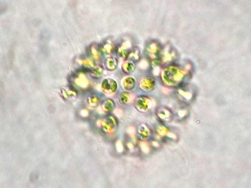 Microcystis_aeruginosa.jpg
